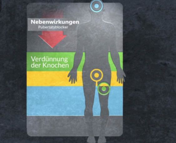Pubertätsblocker – Wer haftet für die Verstümmelung der Kinder? Pubertätsblocker – Wer haftet für die Verstümmelung der Kinder?